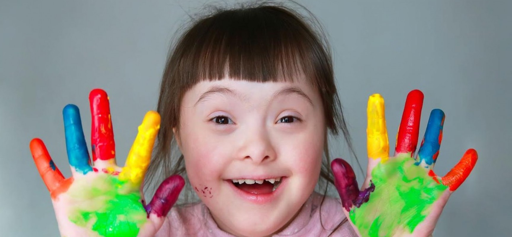 Câmara aprova proposta para substituir “síndrome de Down” por “trissomia do Cromossomo 21”