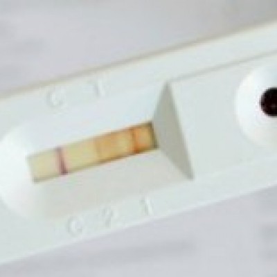 Autoteste de HIV estará disponível nacionalmente até o fim de julho em farmácias