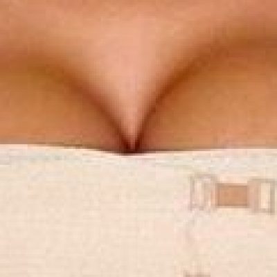 Câmara aprova criação do Banco de Prótese Mamária