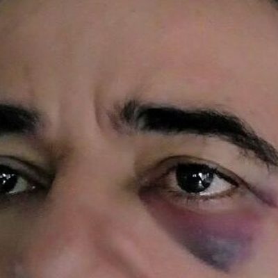 Agente é agredido após tentar desobstruir via ocupada irregularmente por carro de passeio