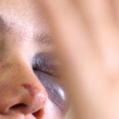 Plenário garante indenização à mulher vítima de violência doméstica