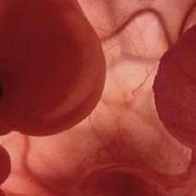 Manifestantes fazem passeata no Rio pela legalização do aborto