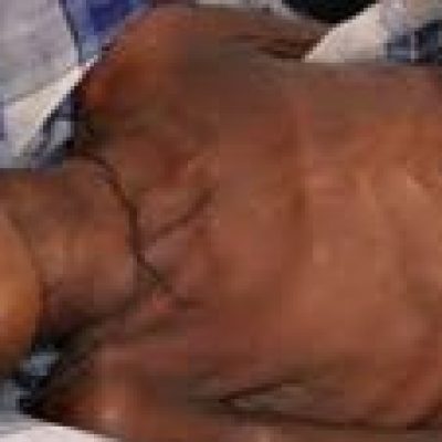 FAO lança campanha Fome Zero para erradicar a fome até 2030