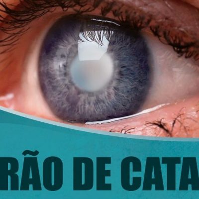Prefeitura de Una realiza triagem para mutirão de cirurgia de catarata