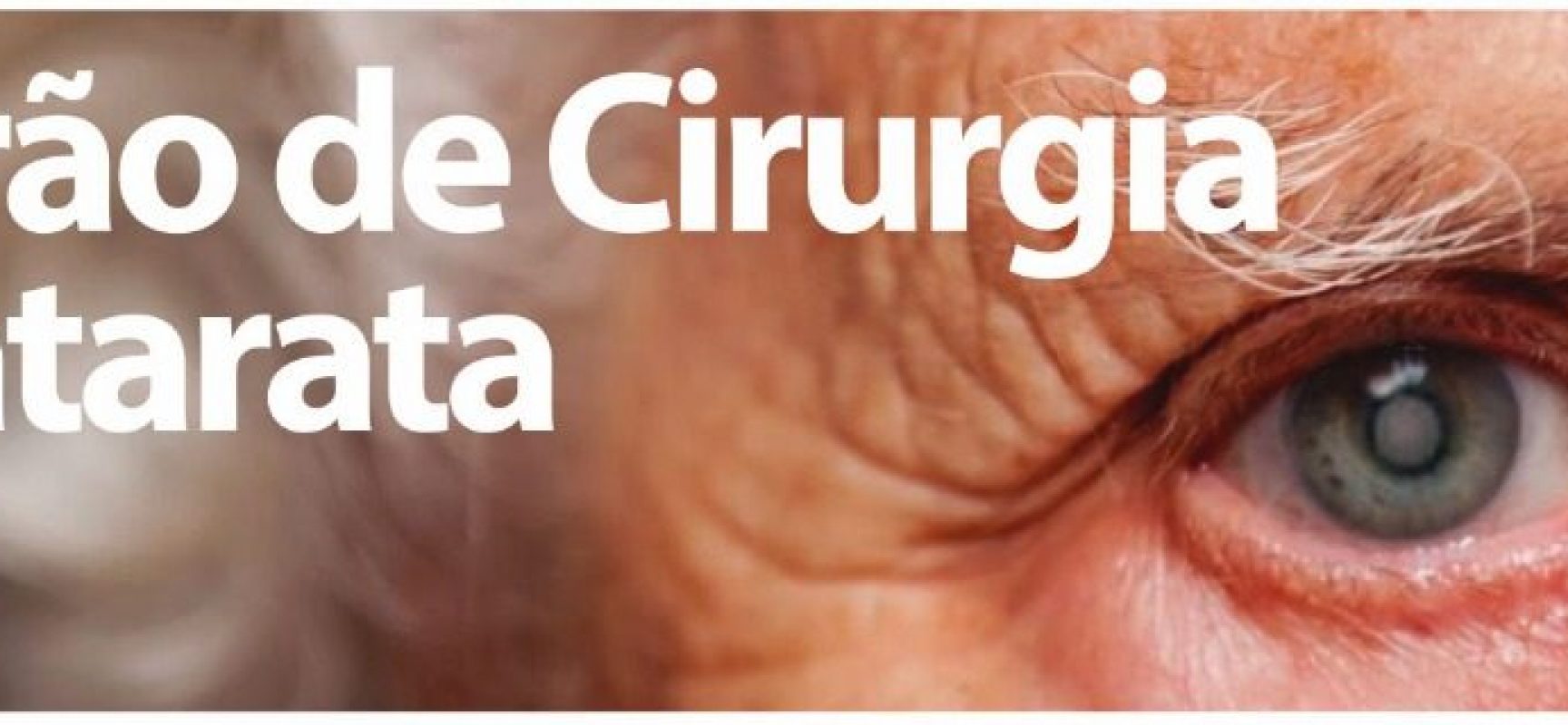 Alterado encerramento do Mutirão de Cirurgia de Catarata para esta quinta (22)