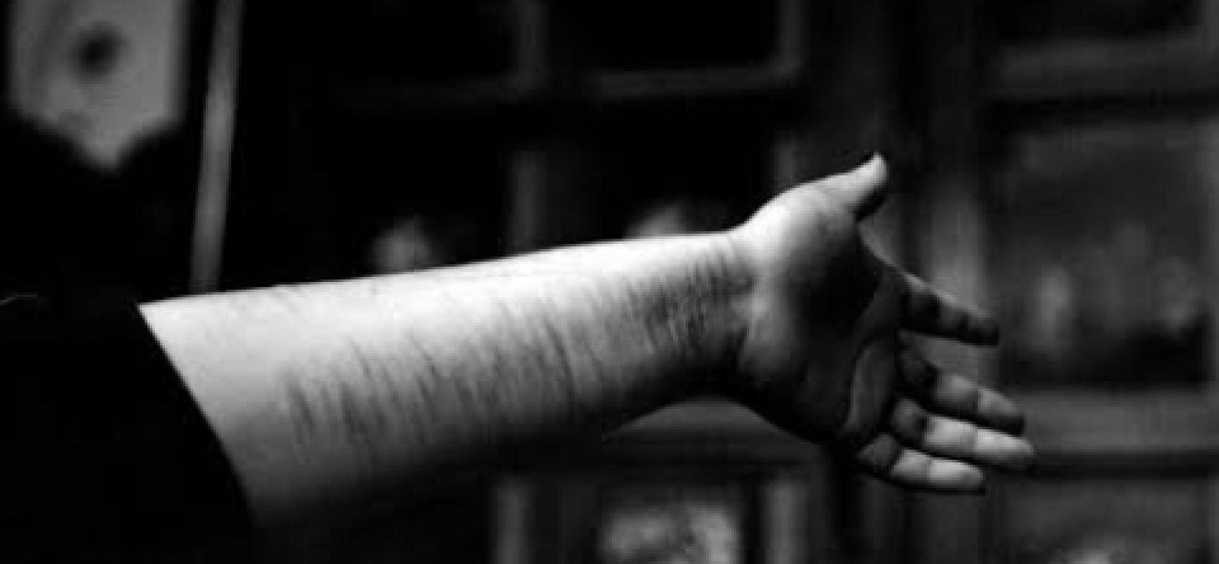 “A PRÁTICA DA AUTOLESÃO NÃO SUICÍDA ENTRE ADOLESCENTES”. Por: Mário Augusto Eccher*