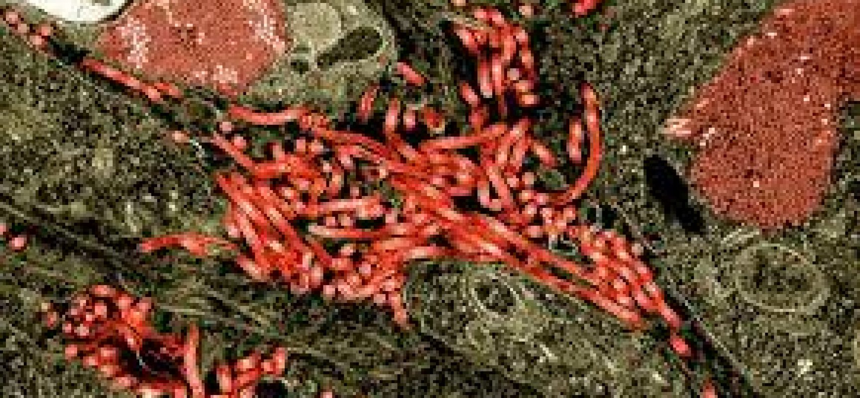 Surto de ebola na África é declarado como situação de emergência de saúde pública internacional