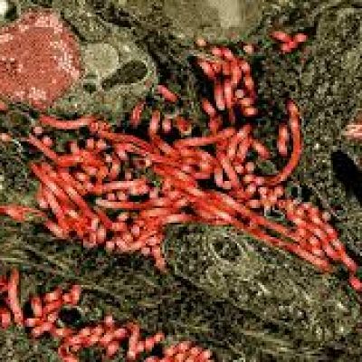 Surto de ebola na África é declarado como situação de emergência de saúde pública internacional