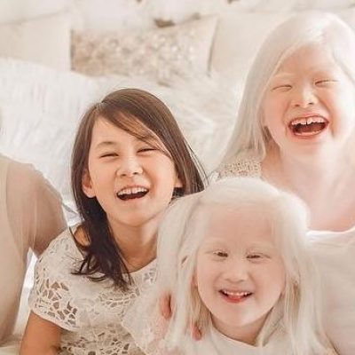 MP promove evento pelo Dia Mundial de Conscientização do Albinismo