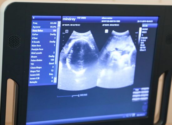 Prefeitura amplia serviço de ultrassonografia obstétrica na rede municipal de saúde