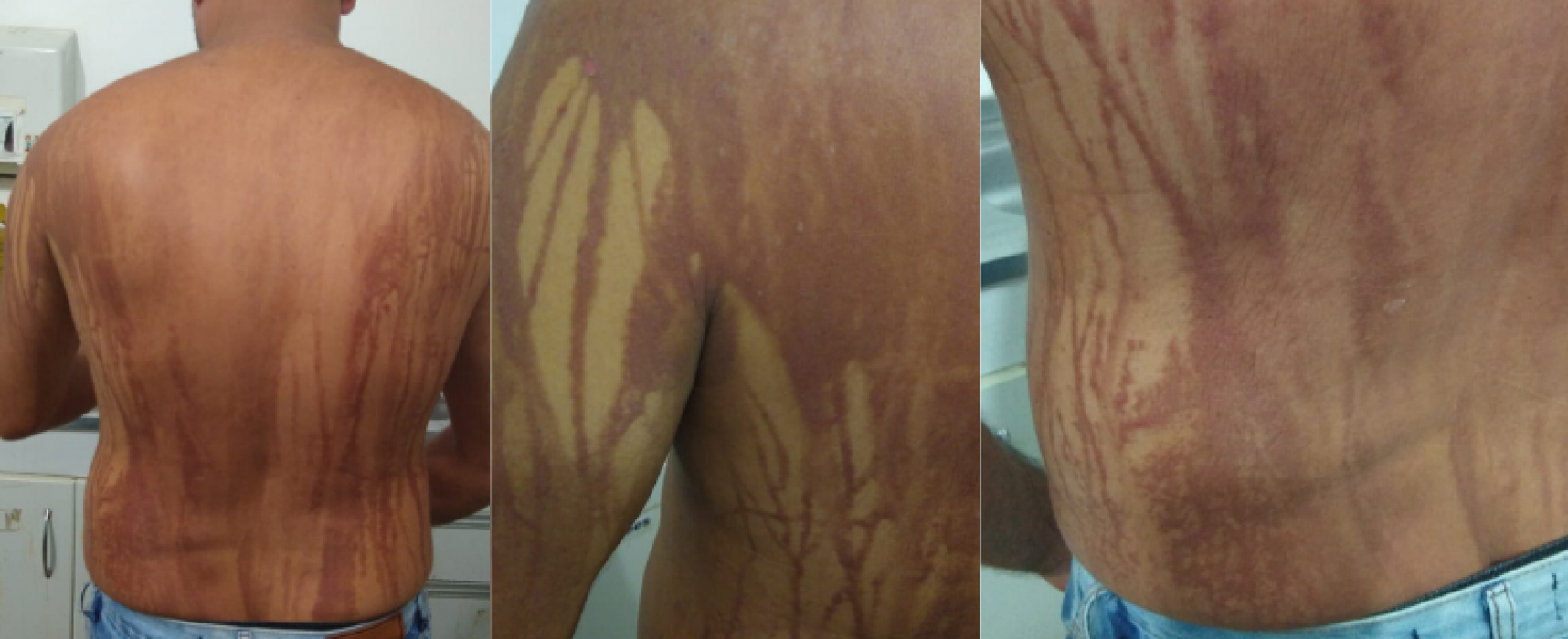 Vigilância investiga relação com óleo vazado nas praias do Nordeste