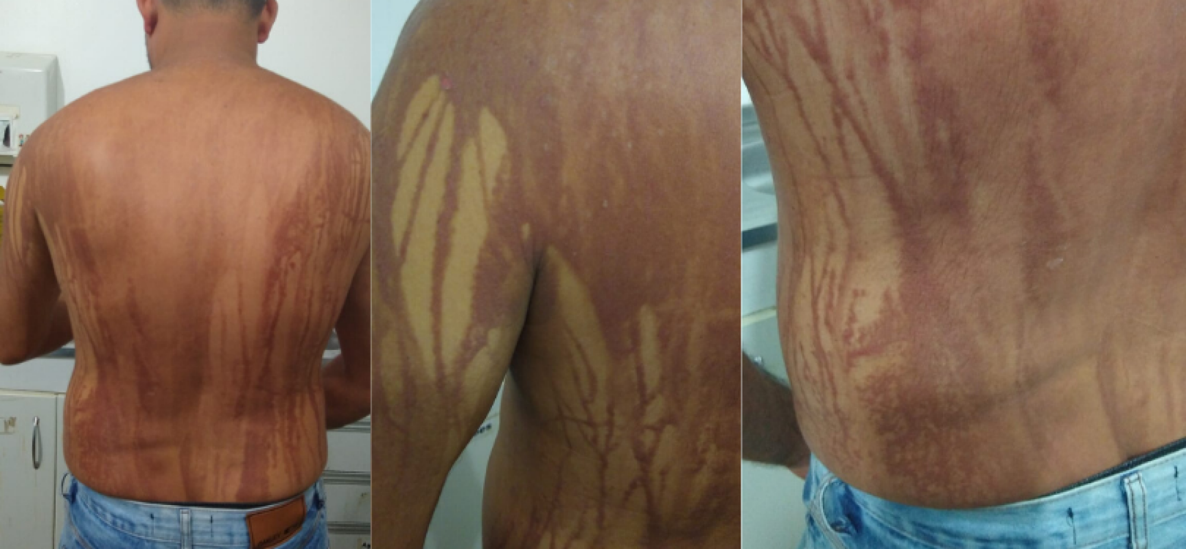 Vigilância investiga relação com óleo vazado nas praias do Nordeste