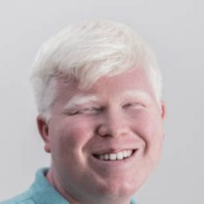 Comissão aprova obrigação de o SUS fornecer protetor solar e óculos escuros a albinos