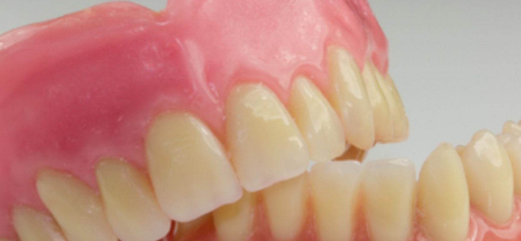Prefeitura de Itacaré entregou gratuitamente 100 prósteses dentárias