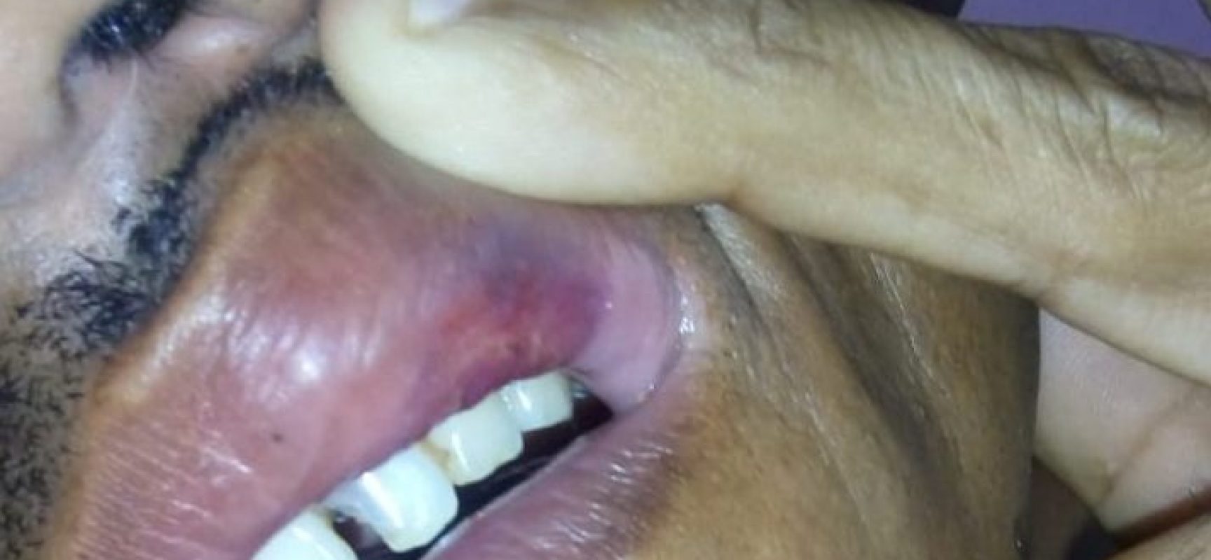 TORTURA: Policiais de Coaraci cometem barbaridades com jovem trabalhador