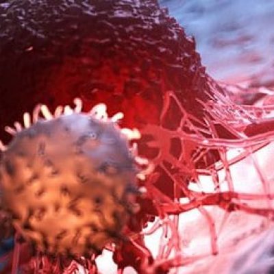 Brasil poderá ter 625 mil novos casos de câncer em 2020