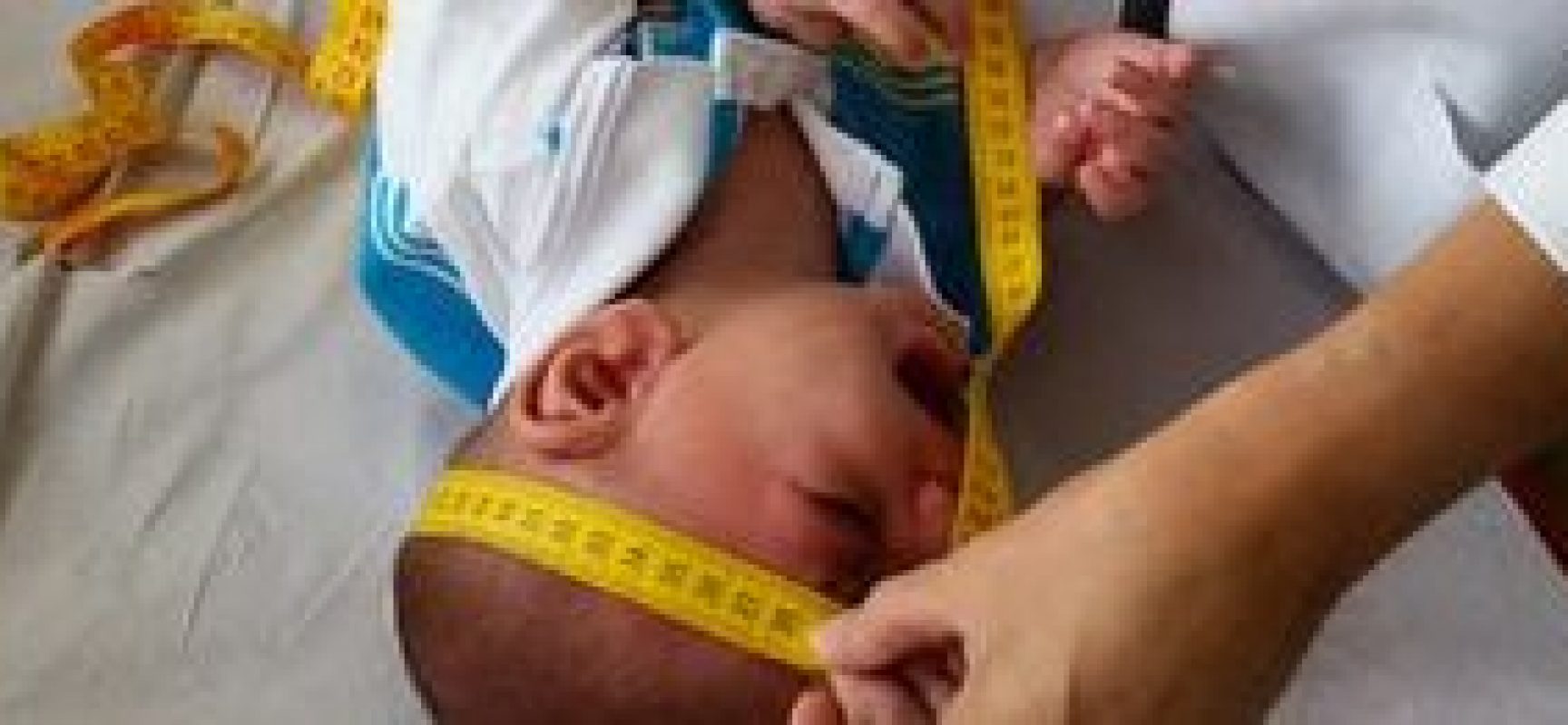 Crianças com microcefalia provocada pelo zika vírus vão receber pensão vitalícia