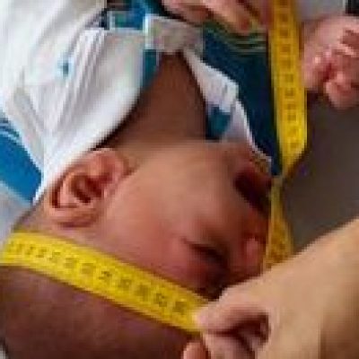 Crianças com microcefalia provocada pelo zika vírus vão receber pensão vitalícia