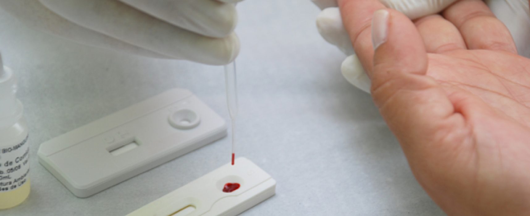 Ilhéus recebe 760 testes rápidos para diagnóstico da Covid-19