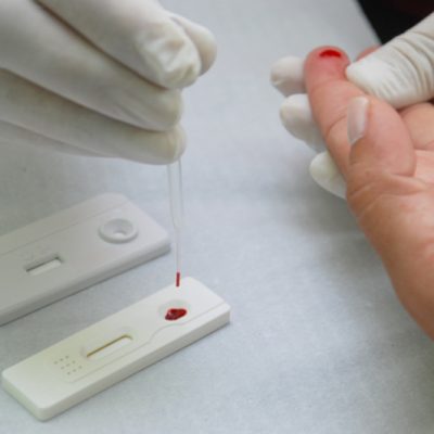 Ilhéus recebe 760 testes rápidos para diagnóstico da Covid-19