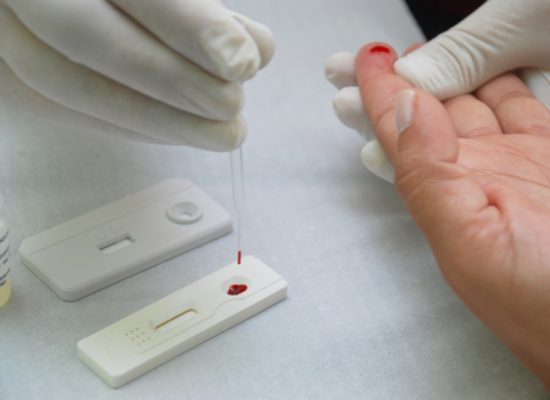Ilhéus recebe 760 testes rápidos para diagnóstico da Covid-19