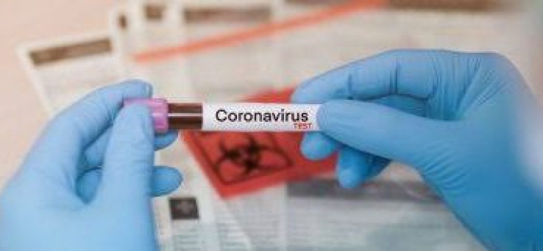 Prefeitura e Estado realizam teste em profissionais da saúde para detecção da Covid-19