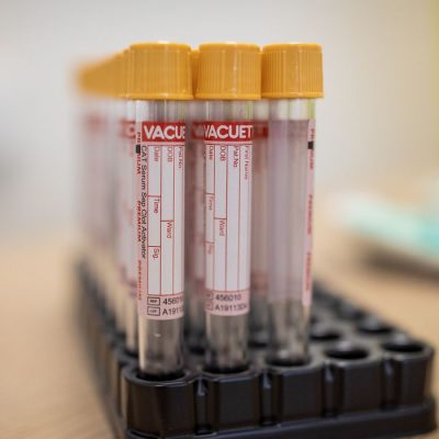Covid-19: Brasil registra 552 óbitos e 30.476 novos casos da doença