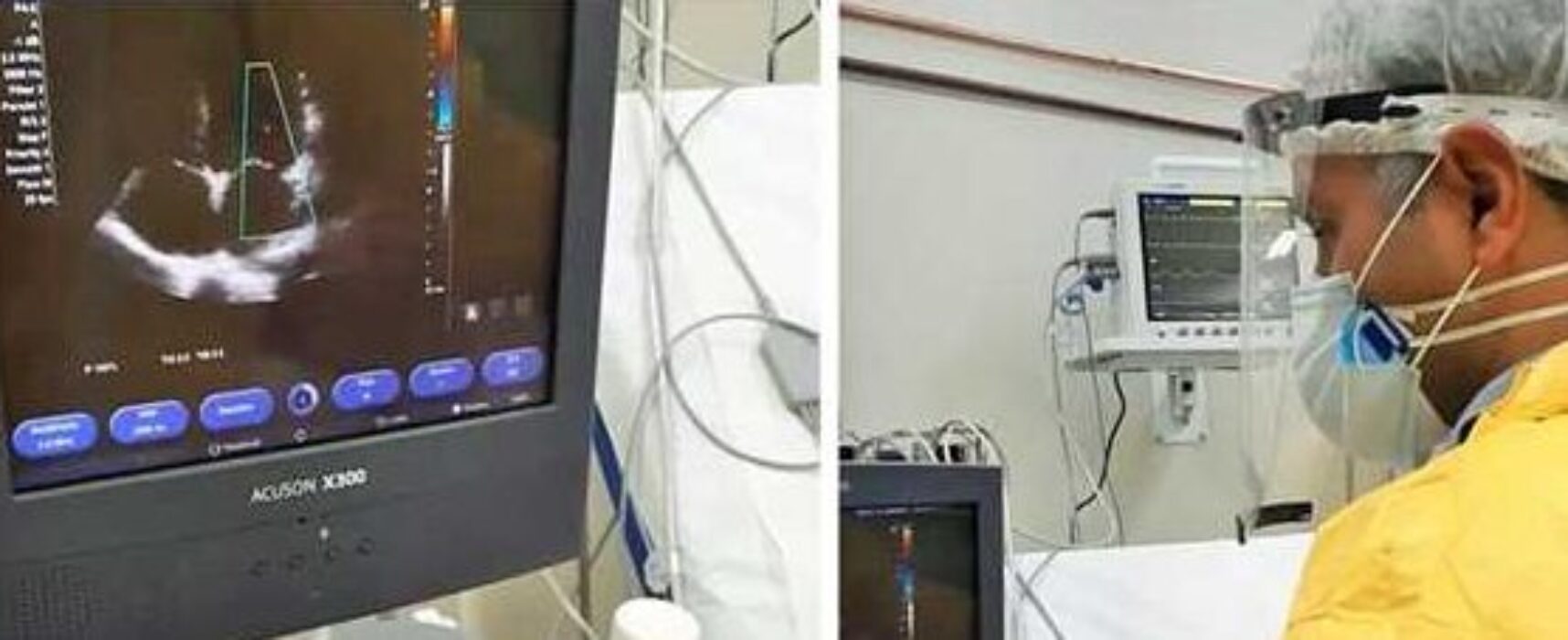 Ilhéus: Centro Covid-19 conta com exame de ultrassom à beira do leito