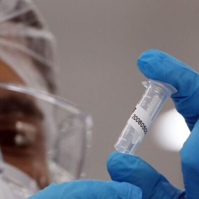 Covid-19 causou 126 mil mortes no Brasil