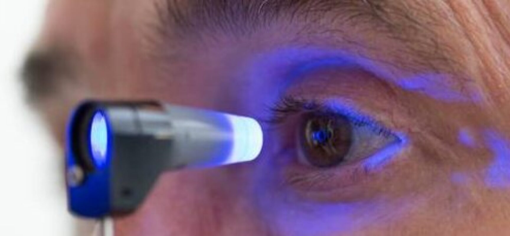 Glaucoma atinge mais de 60 milhões de pessoas no mundo