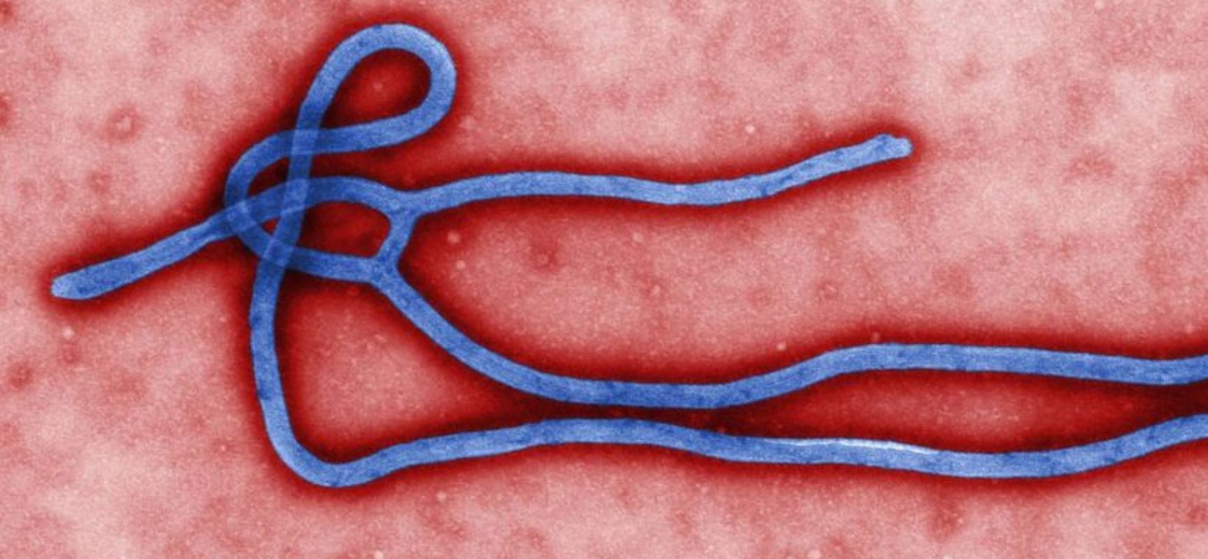 Guiné declara novo surto de ebola