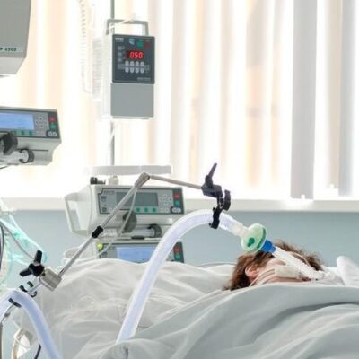 CNM aponta 591 municípios com risco de falta de kit intubação