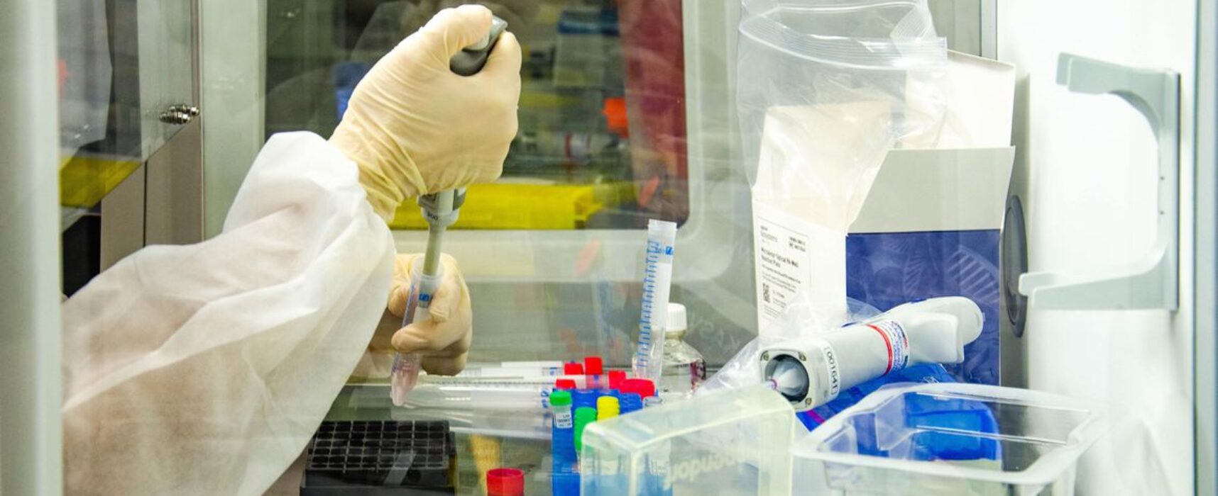 Hemorio estuda tratamento de covid-19 com plasma de vacinados