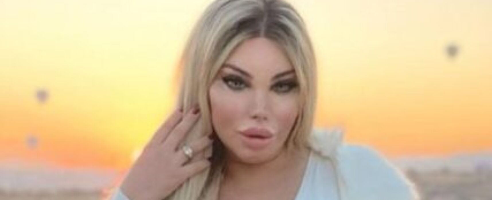 Influencer Jessica Alves, será a primeira mulher trans a realizar transplante de útero