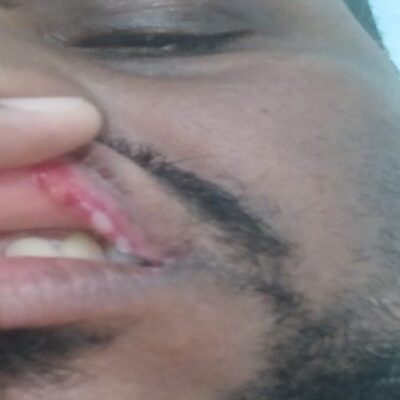 PM agride advogado com tapa no rosto durante abordagem