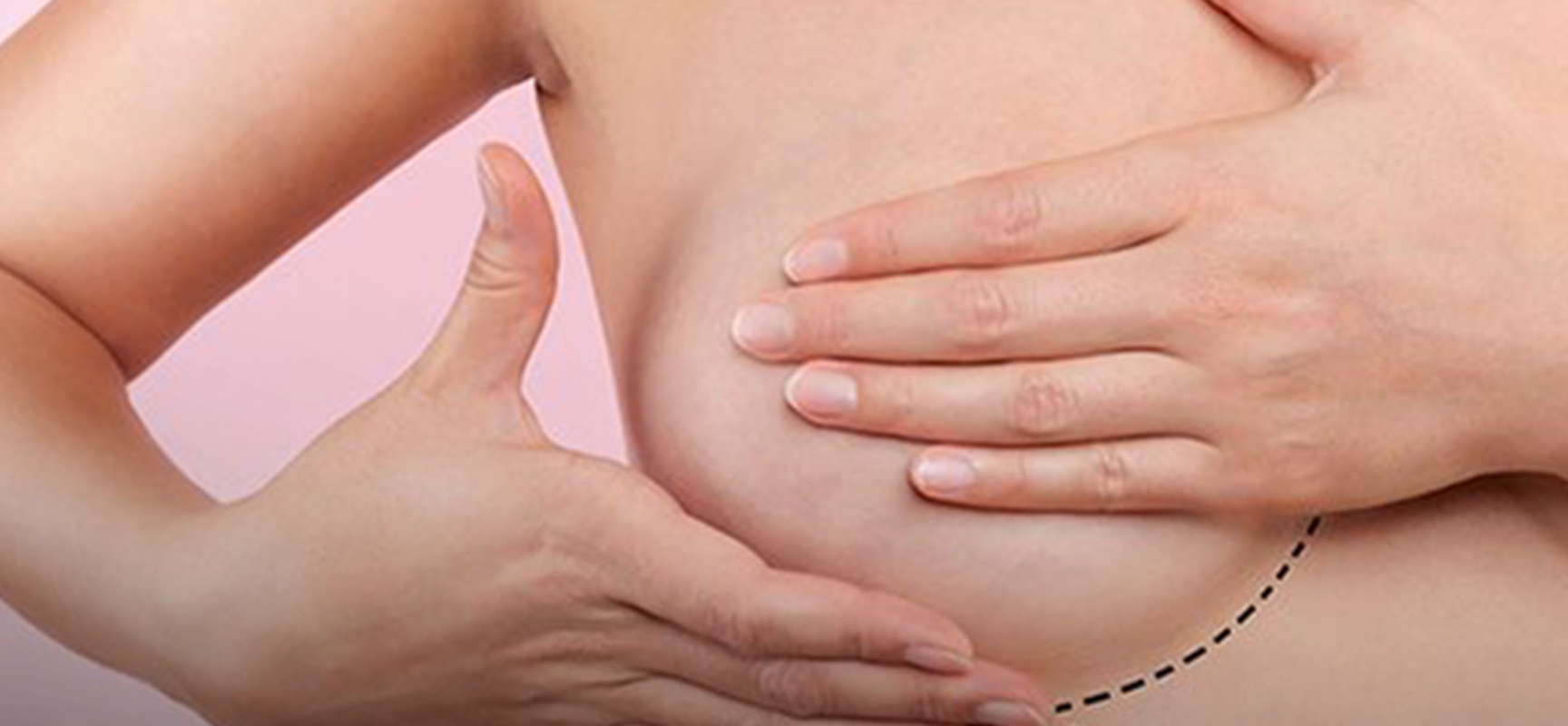Campanha Quanto Antes Melhor alerta para prevenção ao câncer de mama