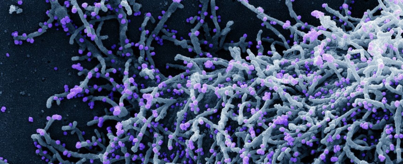 OMS alerta sobre nova fase de covid-19 na Europa