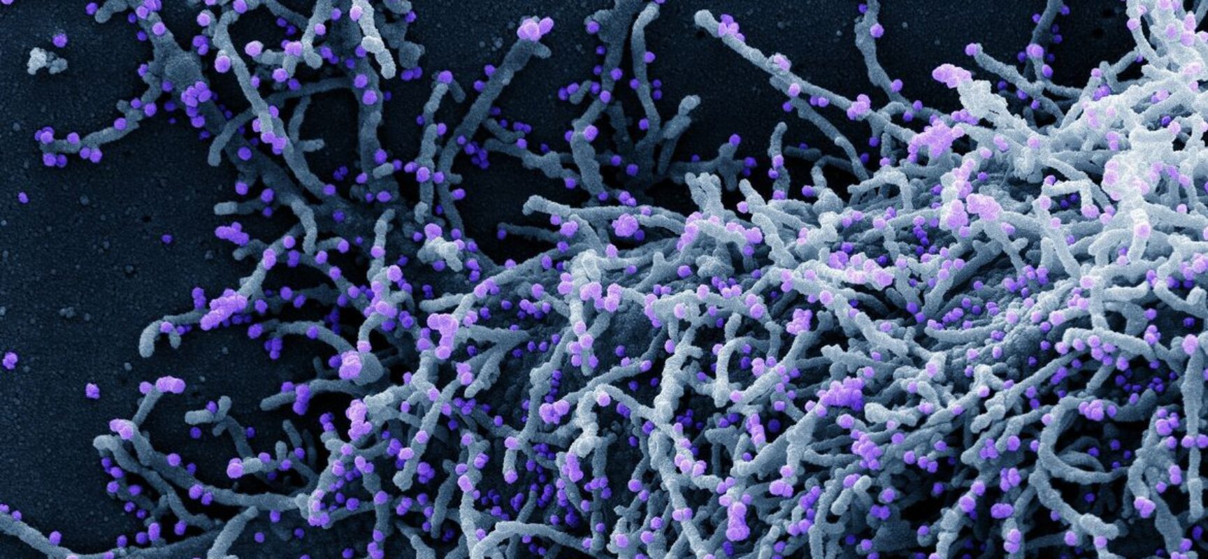 OMS alerta sobre nova fase de covid-19 na Europa