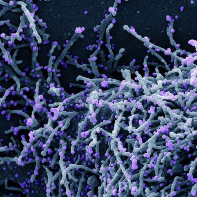 OMS alerta sobre nova fase de covid-19 na Europa