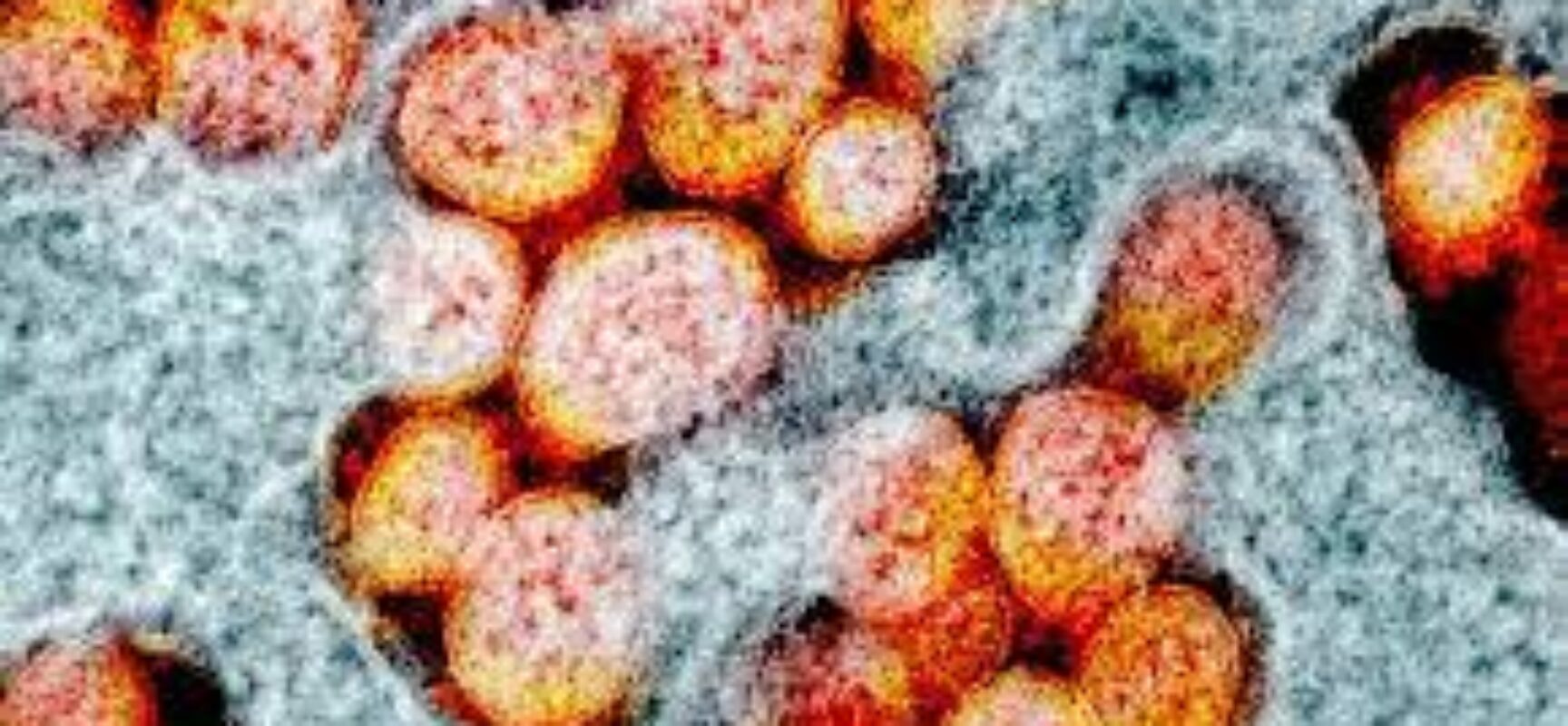 Presidente do Butantan diz que variante Ômicron chegará ao Brasil