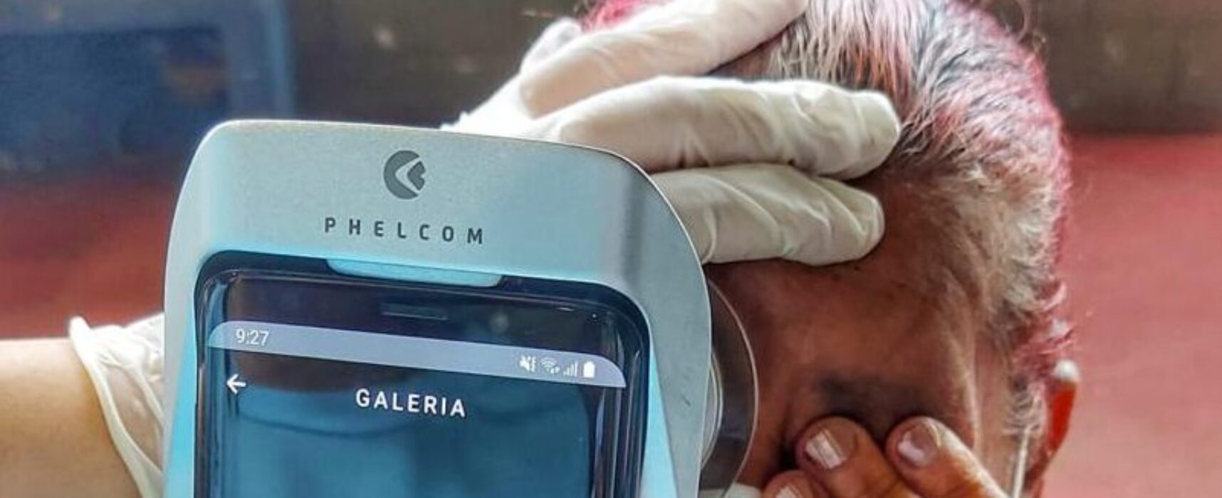 Primeira etapa do  Projeto Unidos Pelo Diabetes em Ação é finalizada em Itabuna