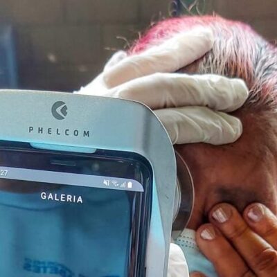 Primeira etapa do  Projeto Unidos Pelo Diabetes em Ação é finalizada em Itabuna