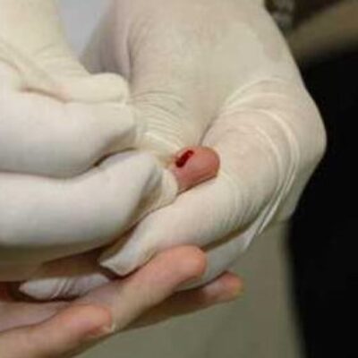 Ilhéus: Saúde realiza blitz de testagem rápida contra HIV/Aids nesta quarta-feira (15)