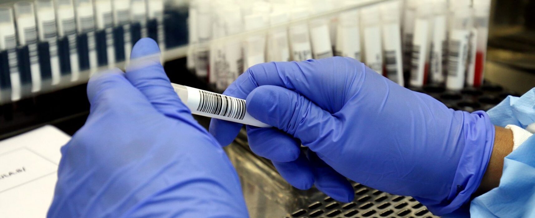 Bahia registra 18 mortes por Covid e mais 991 novos casos da doença em 24h