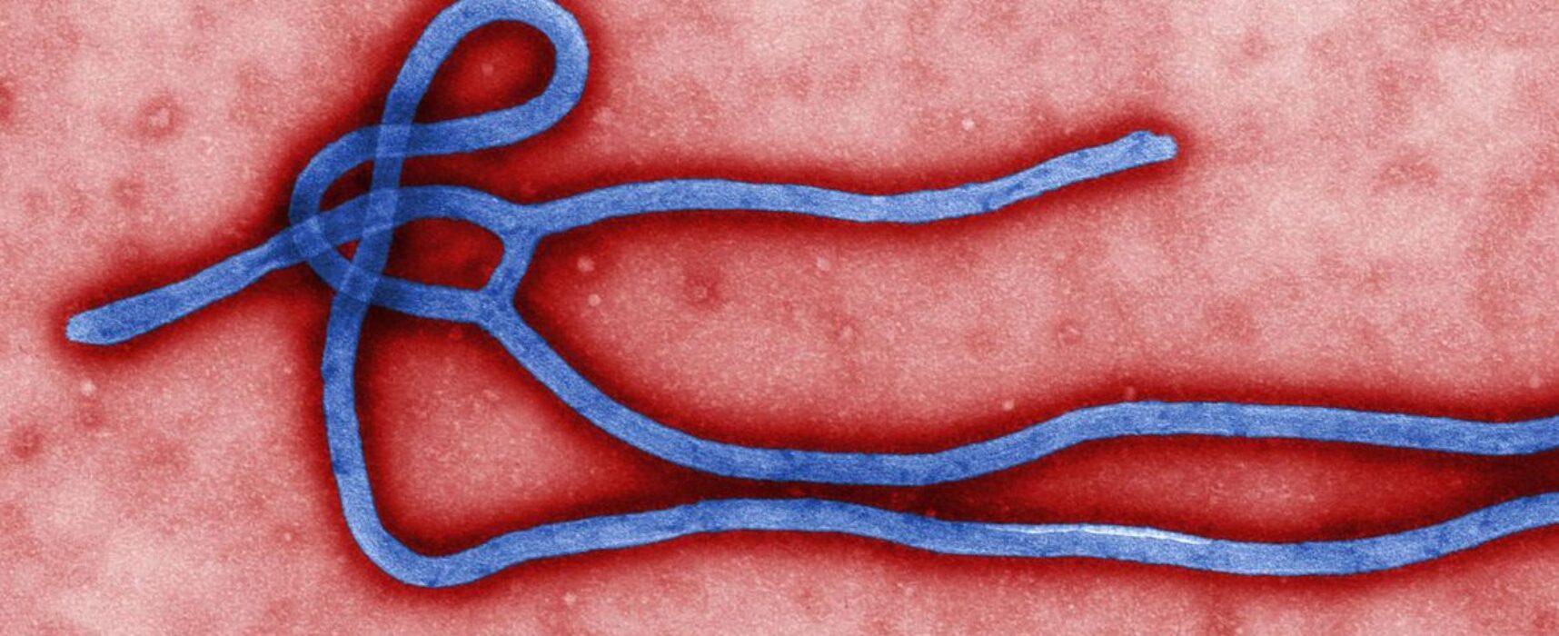Novo surto de ebola atinge a República Democrática do Congo