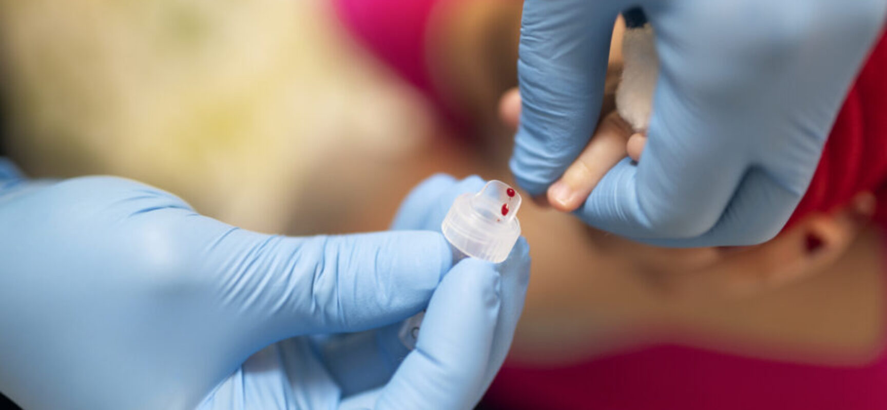 Saúde investiga 7 casos suspeitos de hepatite misteriosa em crianças