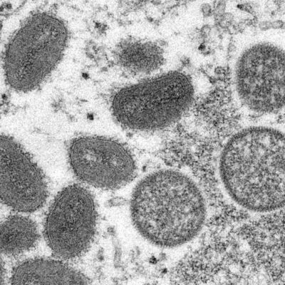 Sesab não confirma caso de varíola dos macacos em Ilhéus