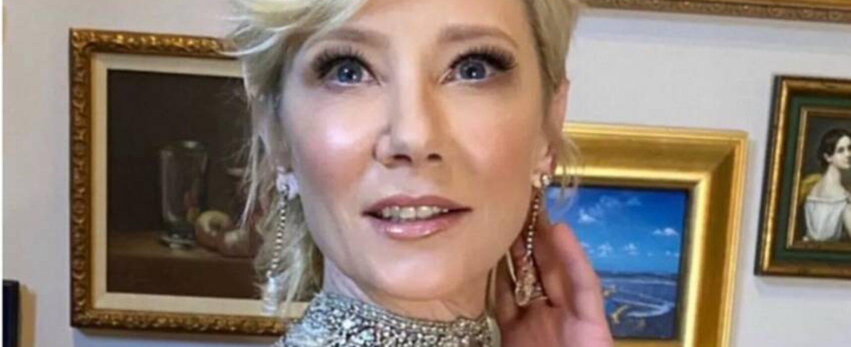 Atriz Anne Heche tem morte cerebral declarada; aparelhos serão desligados