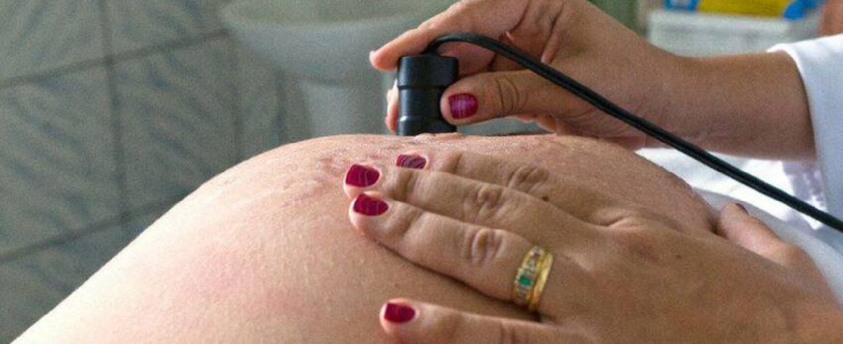 Entidade alerta para risco de diabetes em gestantes