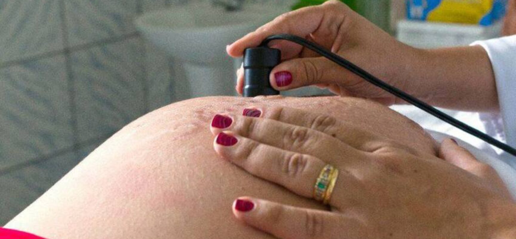 Entidade alerta para risco de diabetes em gestantes